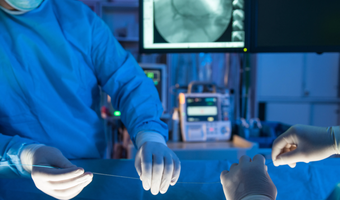 angioplasty